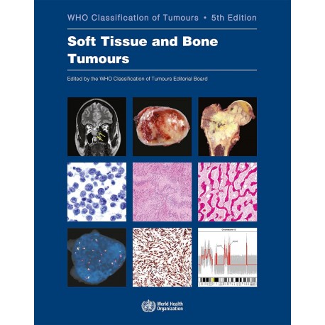 Soft Tissue and Bone Tumours WHO Classification of Tumours, 5th