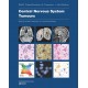 Central Nervous System Tumours WHO Classification of Tumours, 5th