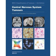Central Nervous System Tumours WHO Classification of Tumours, 5th