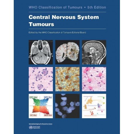 Central Nervous System Tumours WHO Classification of Tumours, 5th