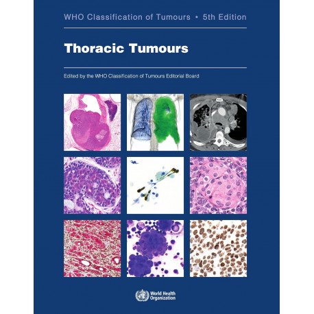 Thoracic Tumours WHO Classification of Tumours, 5th