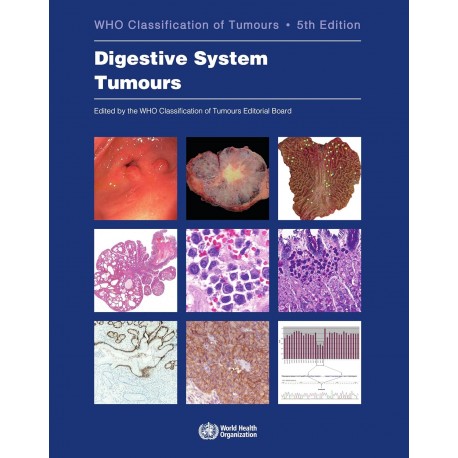 Digestive System Tumours WHO Classification of Tumours, 5th