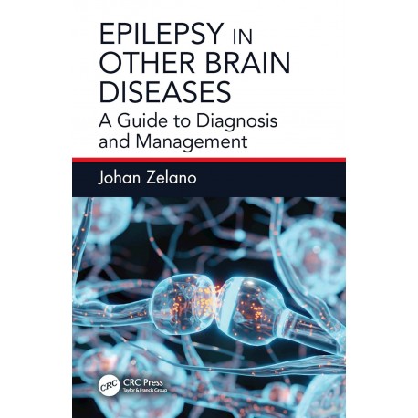 Epilepsy in Other Brain Diseases A Guide to Diagnosis and Management