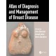 Atlas of Diagnosis and Management of Breast Disease