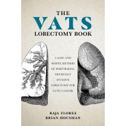 The VATS Lobectomy Book: A Safe and Simple Method of Performing Minimally Invasive Lobectomy for Lung Cancer