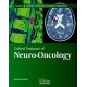 Oxford Textbook of Neuro-Oncology