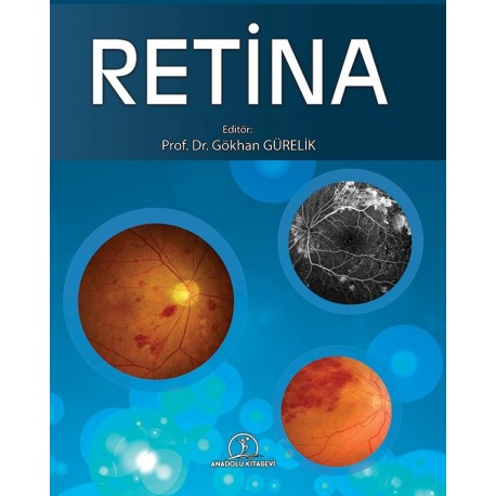 RETİNA -Temel Retina Hastalıklarına Güncel Yaklaşımlar
