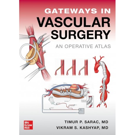 Gateways in Vascular Surgery: An Operative Atlas