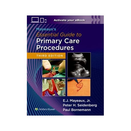 Mayeaux's Essential Guide to Primary Care Procedures: Print + eBook with Multimedia