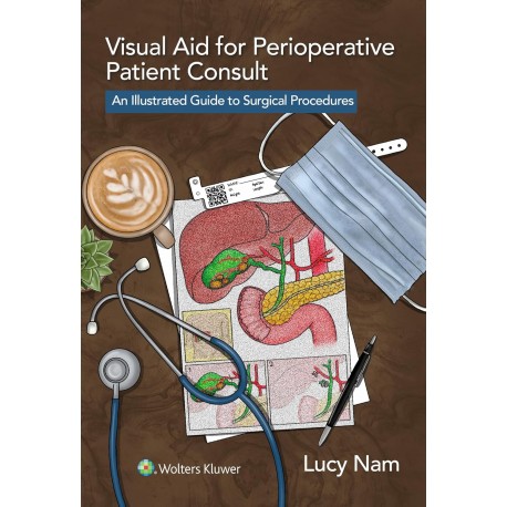 Visual Aid for Perioperative Patient Consult An Illustrated Guide to Surgical Procedures