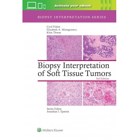 Biopsy Interpretation of Soft Tissue Tumors: Print + eBook with Multimedia,3Edition