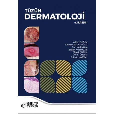 Tüzün Dermatoloji 4.Baskı