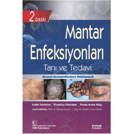 Mantar Enfeksiyonları Tanı ve Tedavi