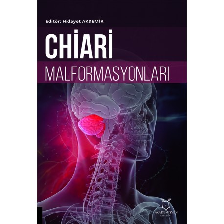 Chiari Malformasyonları Chiari Malformasyonları