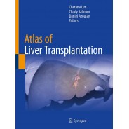 Atlas of Liver Transplantation