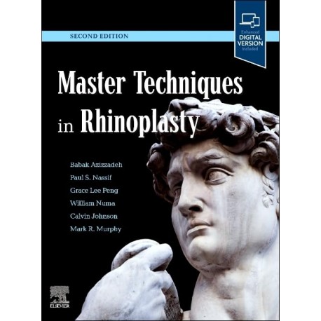 Master Techniques in Rhinoplasty, 2nd Edition