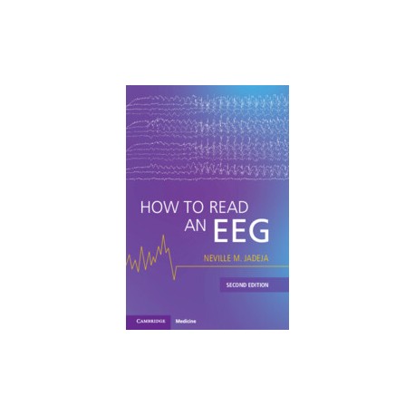 How to Read an EEG