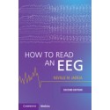 How to Read an EEG