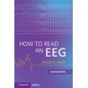 How to Read an EEG