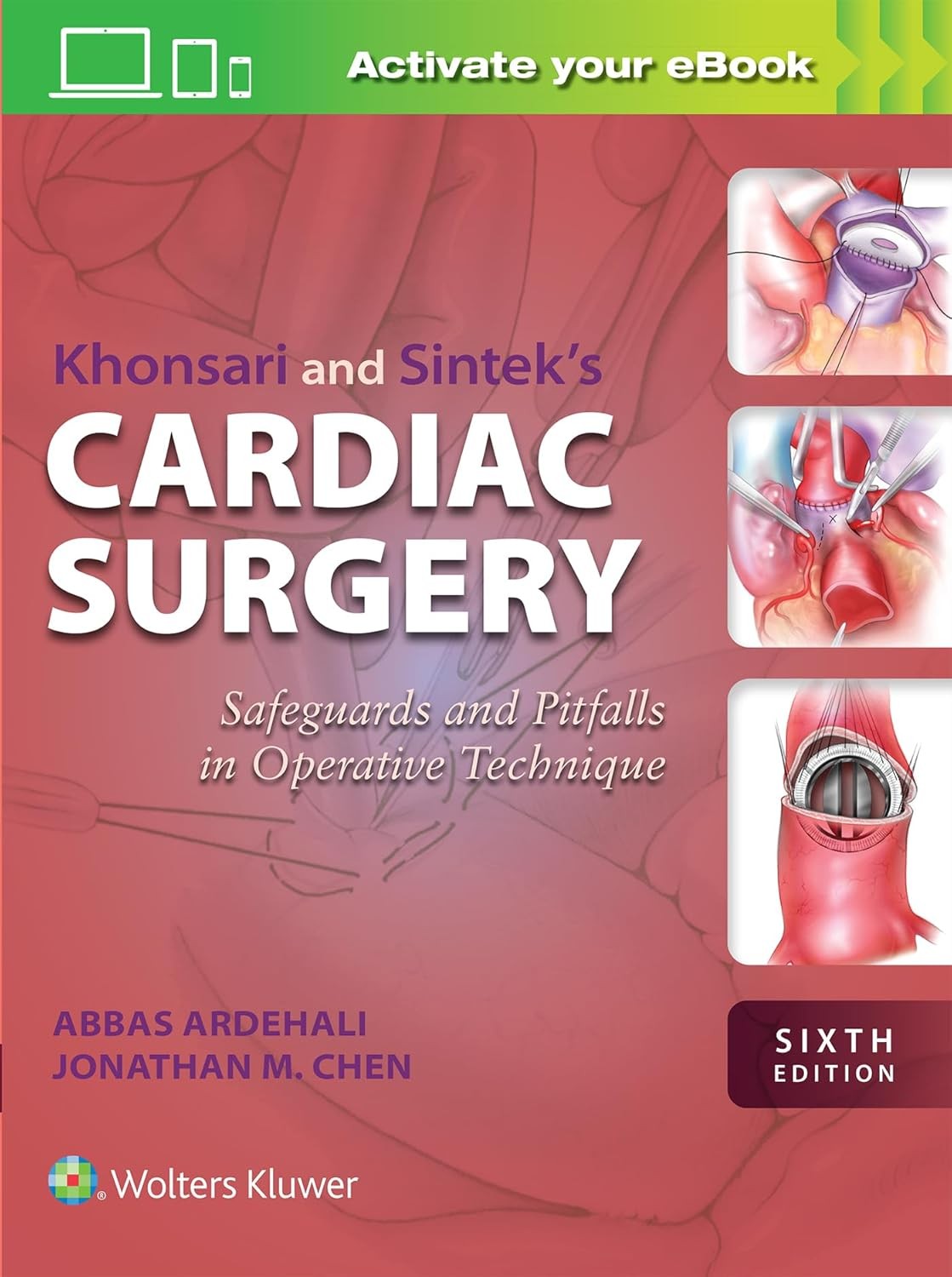 Khonsari and Sintek's Cardiac Surgery Safeguards and Pitfalls in