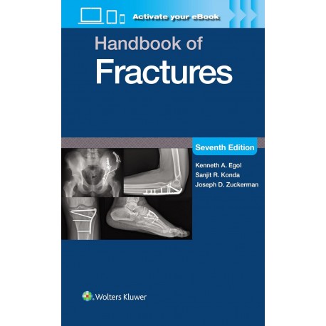 Handbook of Fractures Print + eBook with Multimedia,7 Edition