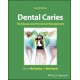 Dental Caries: The Disease and its Clinical Management,4th Edition