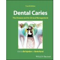 Dental Caries: The Disease and its Clinical Management,4th Edition