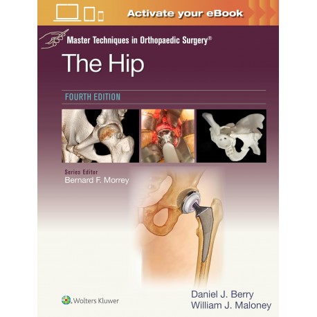 Master Techniques in Orthopaedic Surgery The Hip Print + eBook with Multimedia