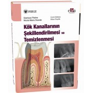 Kök Kanallarının Şekillendirilmesi ve Temizlenmesi