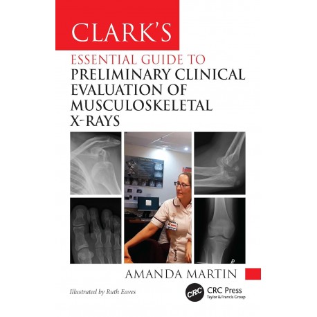 Clark’s Essential Guide to Preliminary Clinical Evaluation of Musculoskeletal X-rays