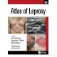 Atlas of Leprosy