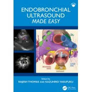 Endobronchial Ultrasound Made Easy