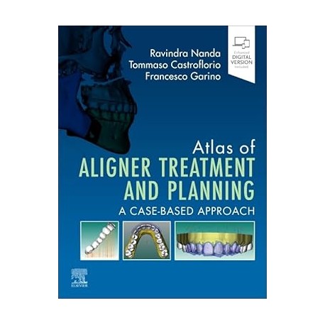 Atlas of Aligner Treatment and Planning: A Case-Based Approach