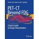 PET-CT Beyond FDG Authors Further product information A Quick Guide to Image Interpretation,