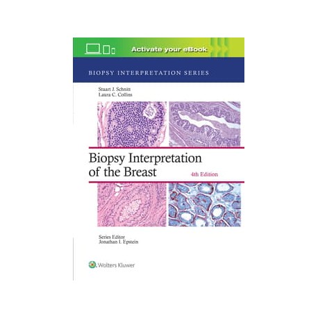 Biopsy Interpretation of the Breast: Print + eBook with Multimedia,4th Edition Biopsy Interpretation of the Breast: Print + eBook with Multimedia,4th Edition