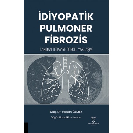 İdiyopatik Pulmoner Fibrozis Tanıdan Tedaviye Güncel Yaklaşım İdiyopatik Pulmoner Fibrozis Tanıdan Tedaviye Güncel Yaklaşım