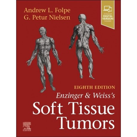 Enzinger and Weiss's Soft Tissue Tumors, 8th Edition Enzinger and Weiss's Soft Tissue Tumors, 8th Edition