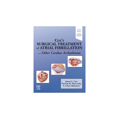 Cox’s Surgical Treatment of Atrial Fibrillation Cox’s Surgical Treatment of Atrial Fibrillation