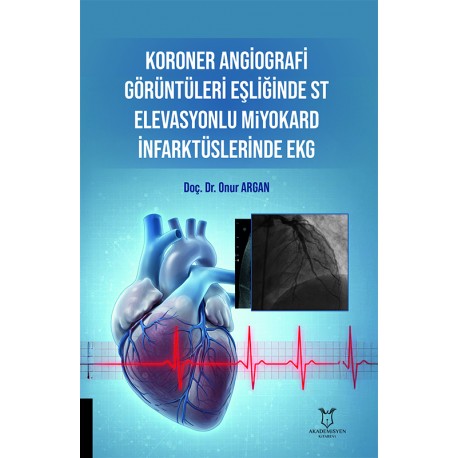 Koroner Angiografi Görüntüleri Eşliğinde ST Elevasyonlu Miyokard İnfarktüslerinde EKG