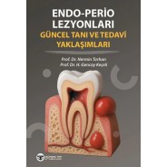 Endo - Perio Lezyonları Güncel Tanı ve Tedavi Yaklaşımları