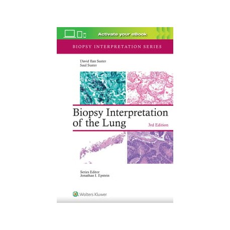 Biopsy Interpretation of the Lung Print + ebook with Multimedia,3th Edition Biopsy Interpretation of the Lung Print + ebook with Multimedia,3th Edition