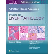 Atlas of Liver Pathology: A Pattern-Based Approach, 2 Edition