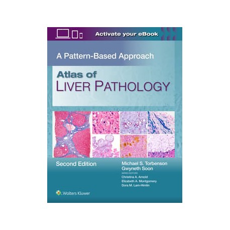 Atlas of Liver Pathology: A Pattern-Based Approach, 2 Edition