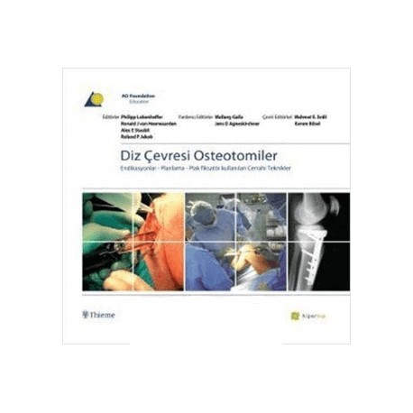 Diz Çevresi Osteotomiler