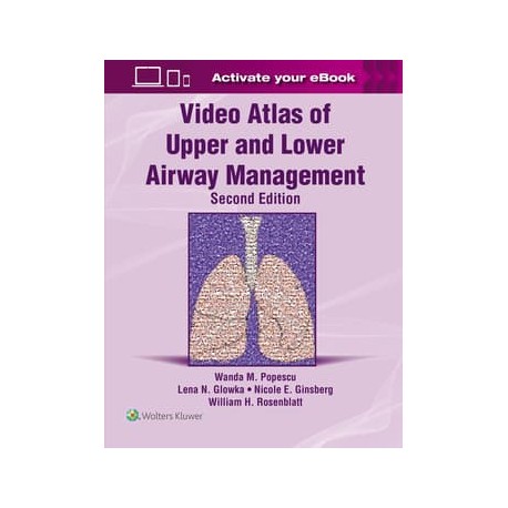Video Atlas of Upper and Lower Airway Management: Print + eBook with Multimedia