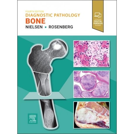 Diagnostic Pathology: Bone, 4th Edition