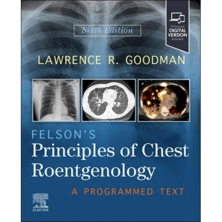 Felson's Principles of Chest Roentgenology, 6th Edition