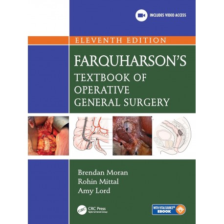 Farquharson's Textbook of Operative General Surgery,11th Edition