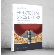 PERKRESTAL SİNÜS LİFTİNG – İllüzyondan Gerçeğe