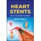 Heart Stents: What You Need to Know